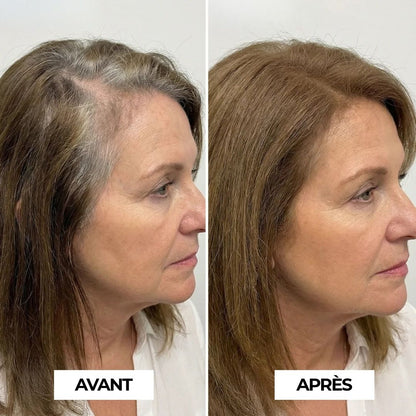 Le Poudrier Précision | Syllia