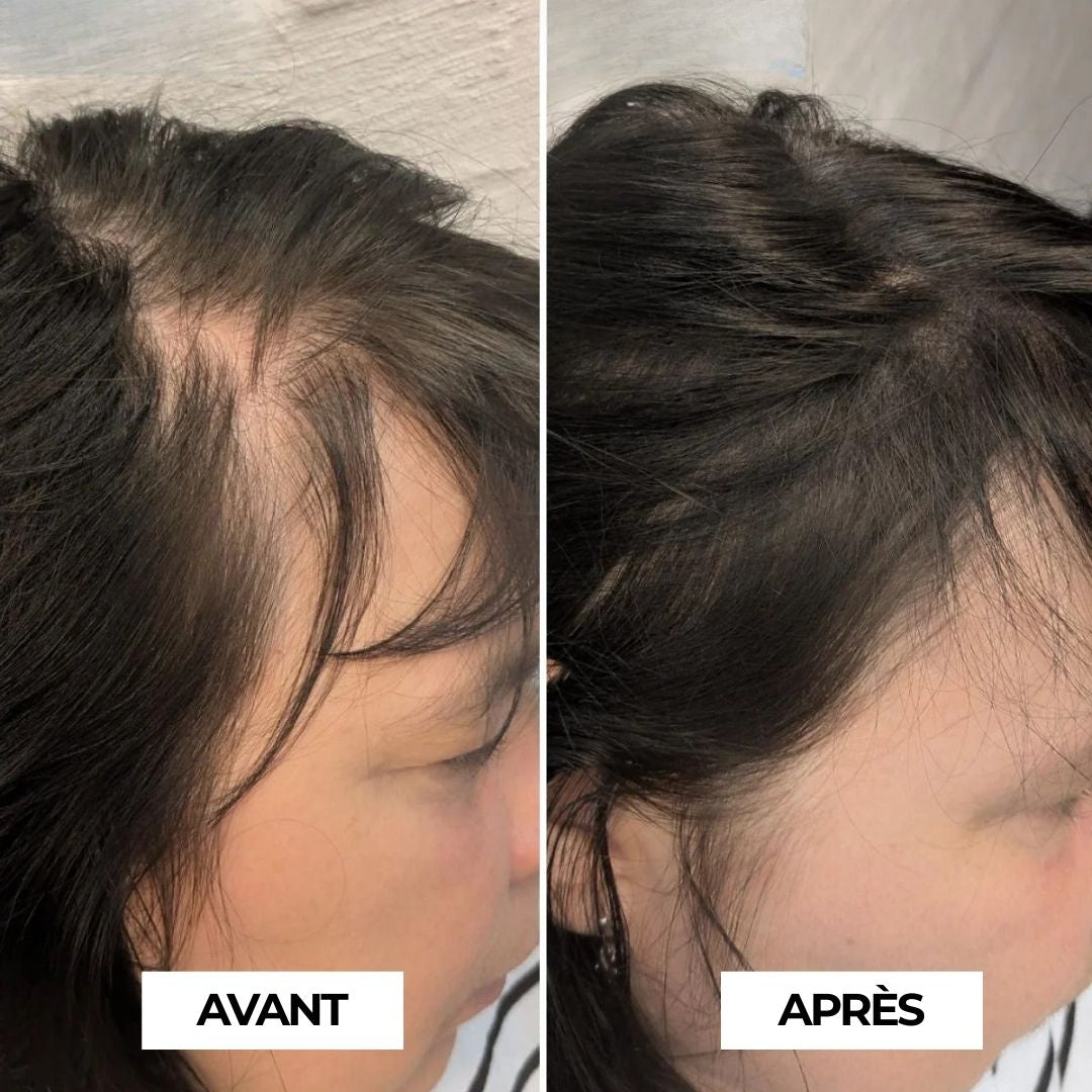 Le Poudrier Précision | Syllia